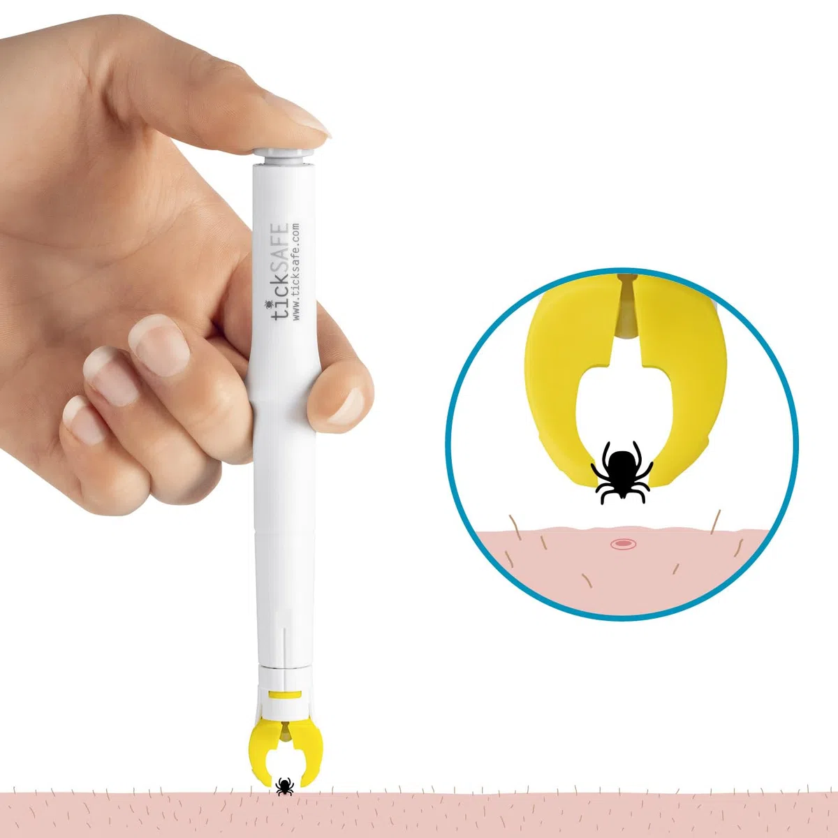 tickSAFE Pinza para garrapatas con Cabezal de Agarre Giratorio para su Uso en el Humanos | La Mejor Pinza para garrapatas - sin apretar, Tirar o presionar - Simplemente Girar hacia Fuera
