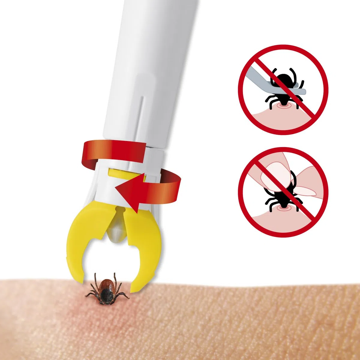 tickSAFE Pinza para garrapatas con Cabezal de Agarre Giratorio para su Uso en el Humanos | La Mejor Pinza para garrapatas - sin apretar, Tirar o presionar - Simplemente Girar hacia Fuera